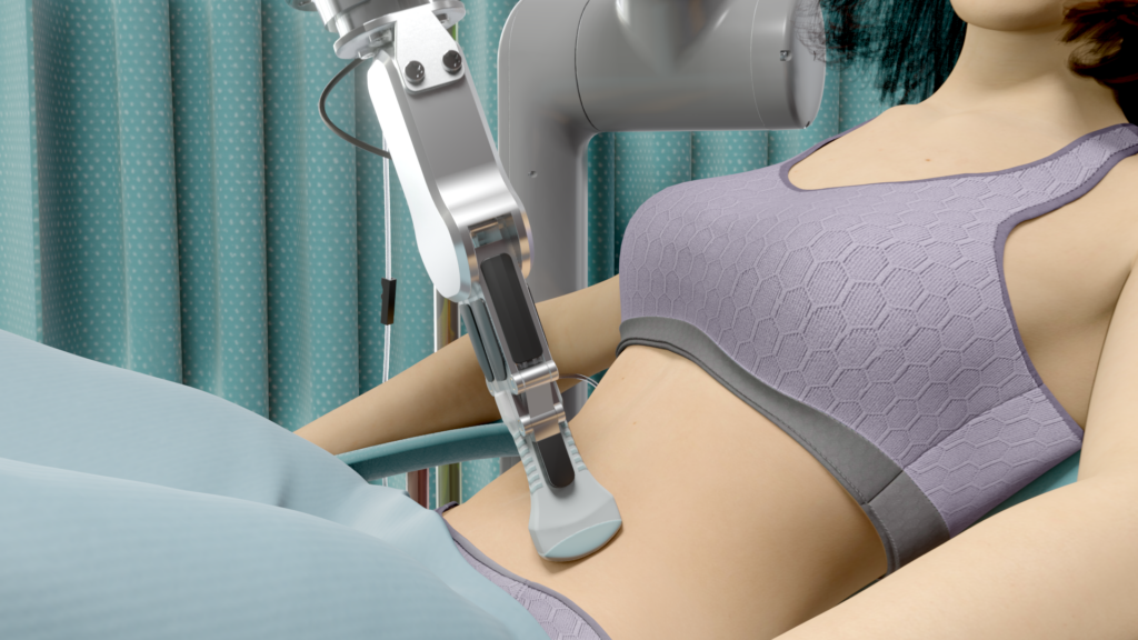 Render of a robot arm for endometriosis